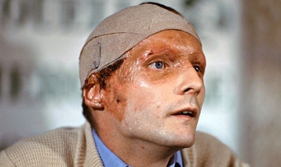 F1 driver Niki Lauda at a press conference in 1976 following his crash and subsequent burns at the German Grand Prix